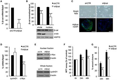 β-Catenin Knockdown Affects Mitochondrial Biogenesis and Lipid Metabolism in Breast Cancer Cells